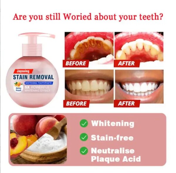 Dentifrice blanchissant intensif, élimination des taches, Soda, blanchiment des dents