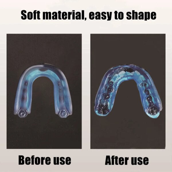 Protège-bouche en gel pour sport professionnel, embout buccal souple