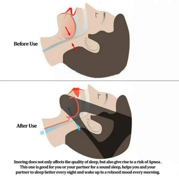 Ceinture anti-ronflement réglable pour hommes et femmes, mentonnière, protège-bouche