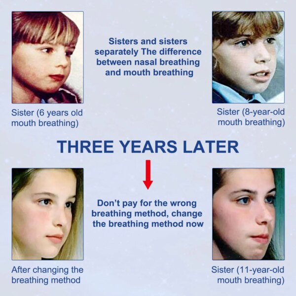 90/30Pcs Sommeil Bandes Bouche Bandes Anti-Ronflement