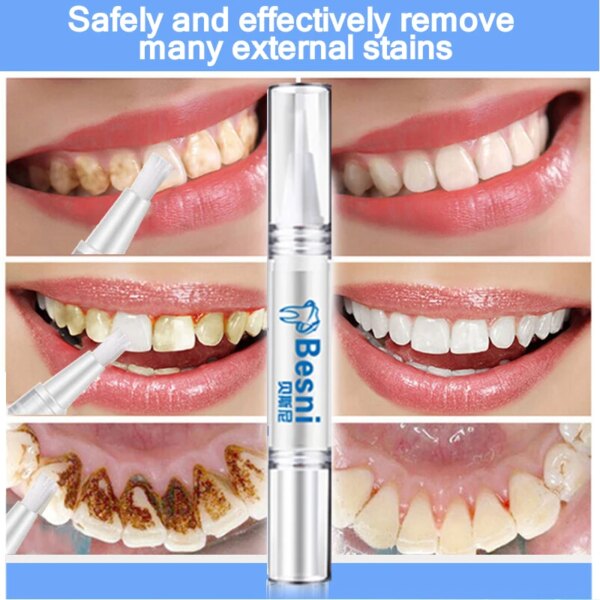 1812-d09d36.jpg Kit blanchiment dentaire – gels en lot (4/8/16 pièces) avec applicateurs