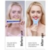 kit blanchiment dentaire, avec 32 Led, stylo Gel de désensibilisation