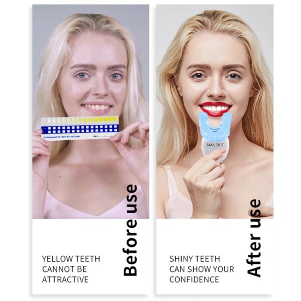 kit blanchiment dentaire, avec 32 Led, stylo Gel de désensibilisation