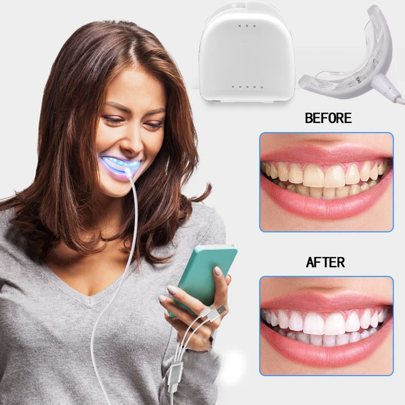 Kit de Blanchiment Dentaire 3-en-1 Portable à LED  - kit blanchiment dentaire chez blanchimo.fr