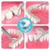 kit blanchiment dentaire professionnel outils de soins dentaires buccaux