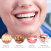 kit blanchiment dentaire professionnel à 16 LED, 4 pièces, stylo 35% peroxyde de Carbamide