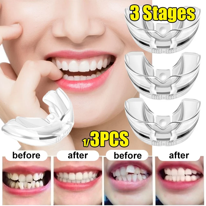Appareil Orthodontique en Silicone – Kit 3 Étapes 
