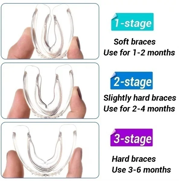 7572-a1e31a.jpg dentaire orthodontie en Silicone, Appareil Dentaire 11%, Attelle en Matériau, Garde Professionnel