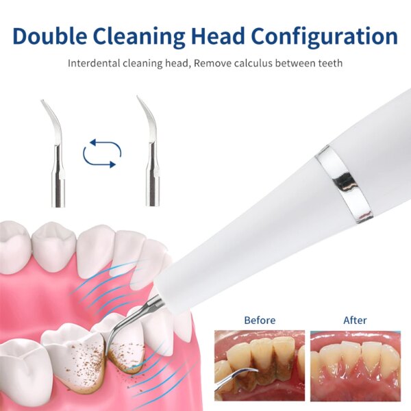 détartrage dentaire Ultrasonique, Kit de Livres Buccaux