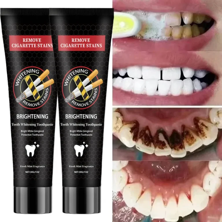 Blanchisseur de dents : ce qui fonctionne vraiment pour un sourire plus net - Blanchisseur de dents