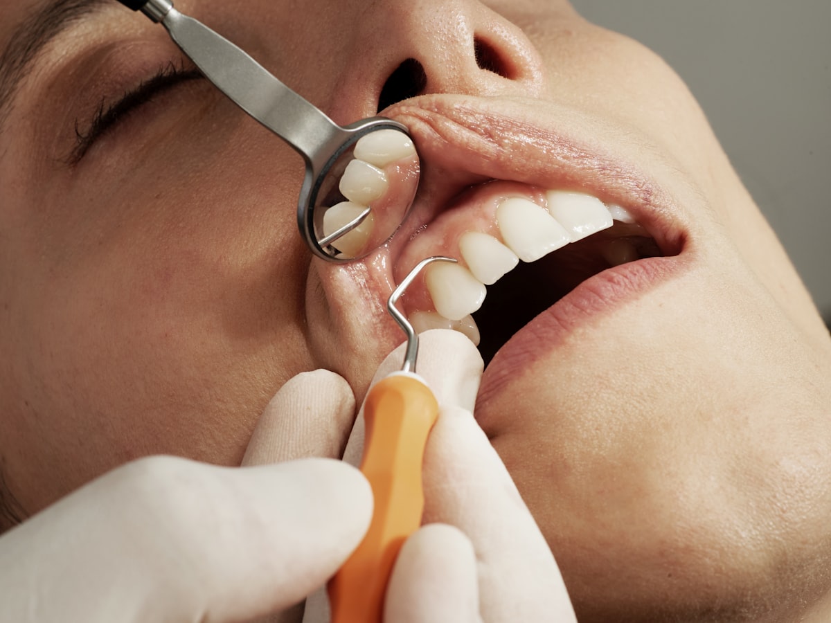 Soins et produits pour blanchiment des dents